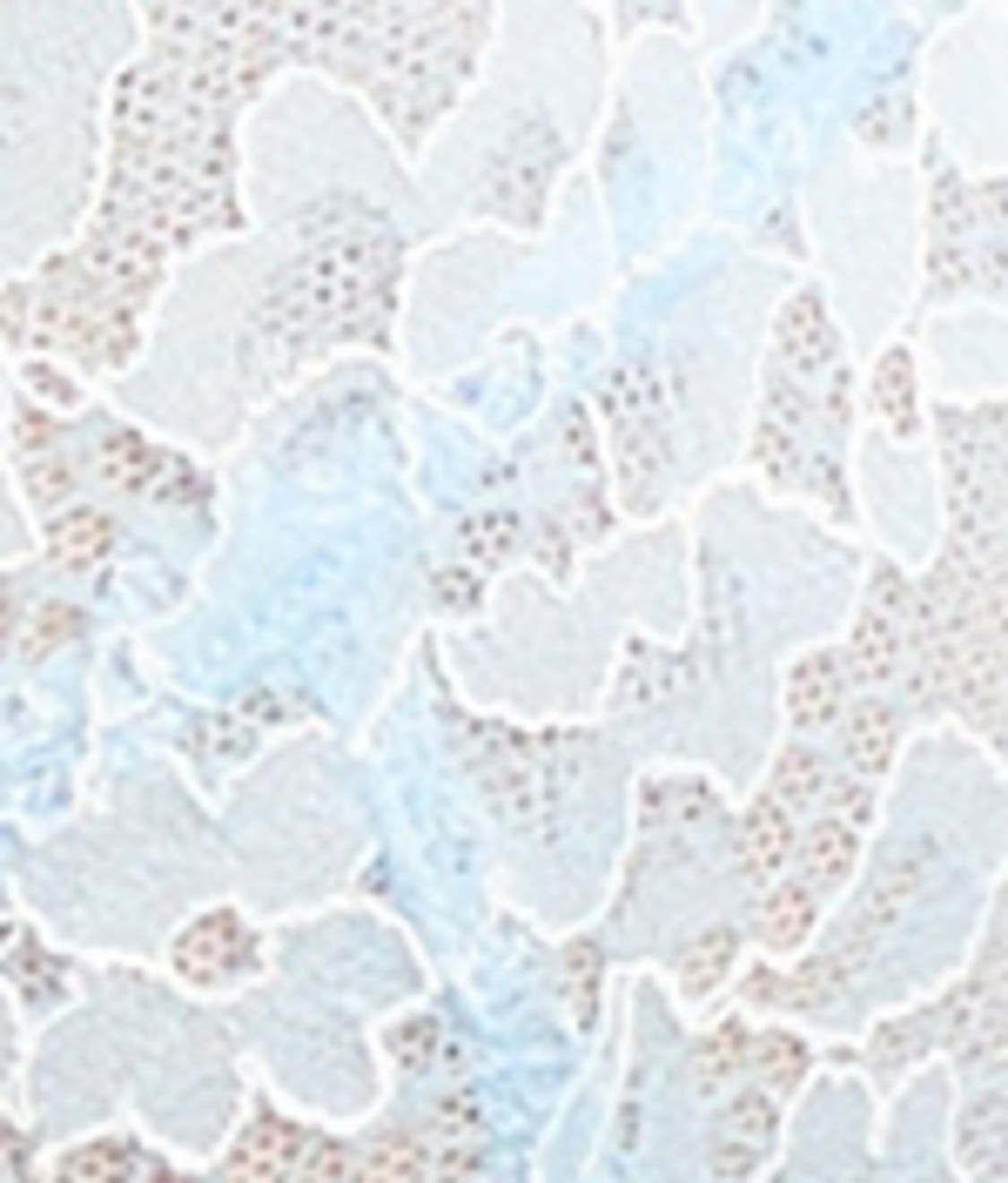 Lace Unlined Side Support Bra